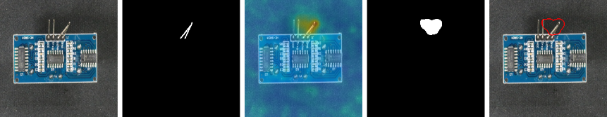 anomalib screenshot 1